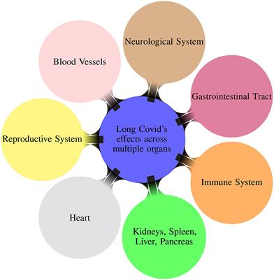 A survey on the role of artificial intelligence in managing Long COVID